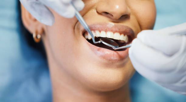 Best Emergency Care for Gum Disease in Friday Harbor, WA