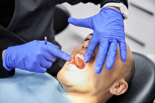 Best Emergency Cosmetic Dentistry (e.g., broken veneers) in Friday Harbor, WA